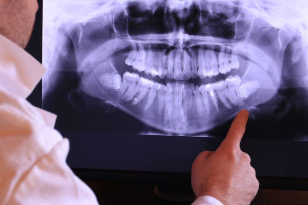 Best Emergency Dental Filling Replacement  in Walford, IA