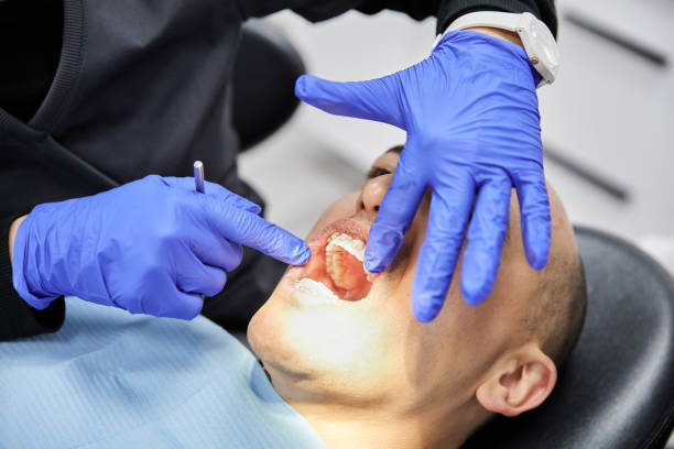 Best Dentist for Tooth Abscess  in Walford, IA